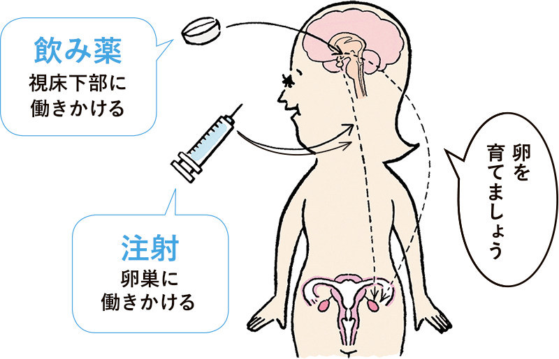 2ページ目(2ページ中) | 妊娠をグイッと後押しする「排卵誘発剤」の効果的な使い方 | 不妊治療・妊活のクリニック探し・情報収集ならあかほし ...