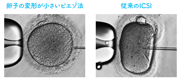 【写真】顕微受精…ピエゾ法と従来のOCSI