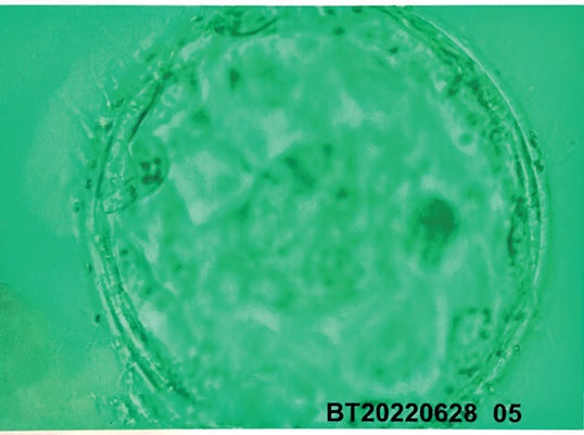新鮮胚移植した胚盤胞