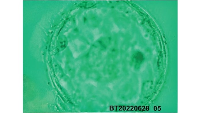 胚盤胞グレード4AB