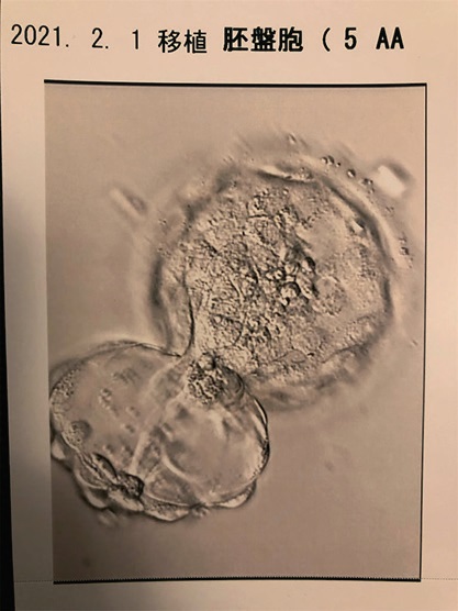 胚盤胞