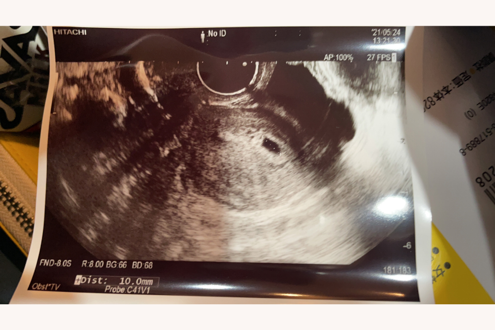 村上めぐみさん