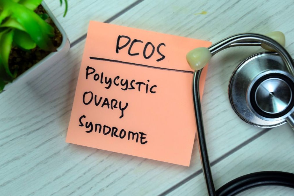 多嚢胞性卵巣症候群